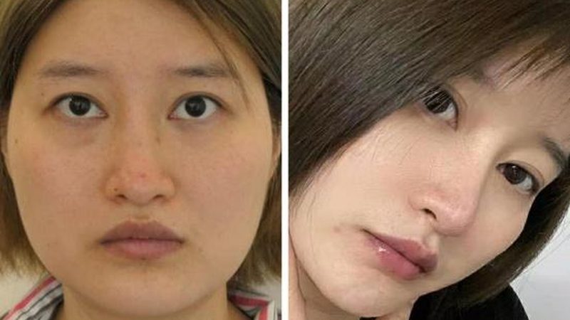 皮肤管理客户登记表：设计要点与功能解析