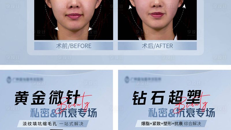 热玛吉效果持久之谜：揭秘维持时间的真相