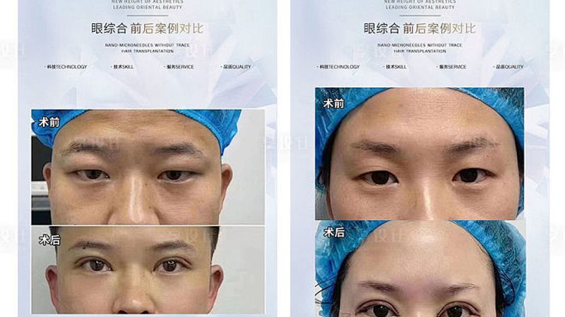 涂抹式玻尿酸代理加盟条件