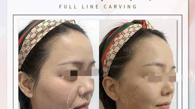 医美咨询师面试，揭秘专业之路的五大步骤