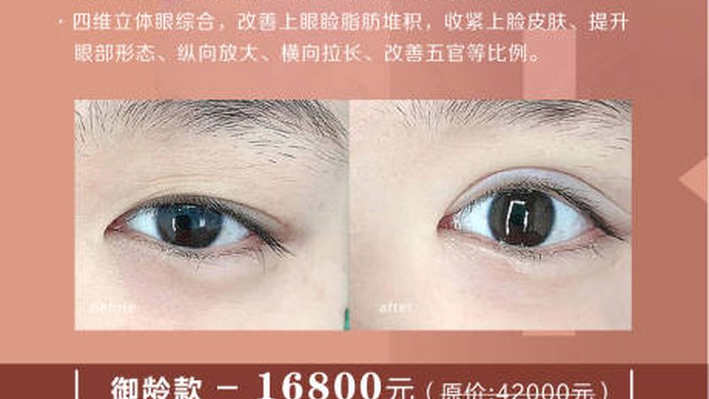 全身激光脱毛2025年多少钱