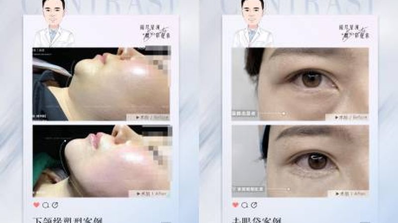 美容院超声炮设备：揭秘其工作原理与选购要点