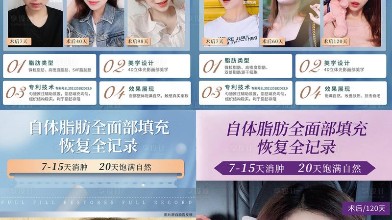 选择合适的注射美容项目需要考虑以下因素：