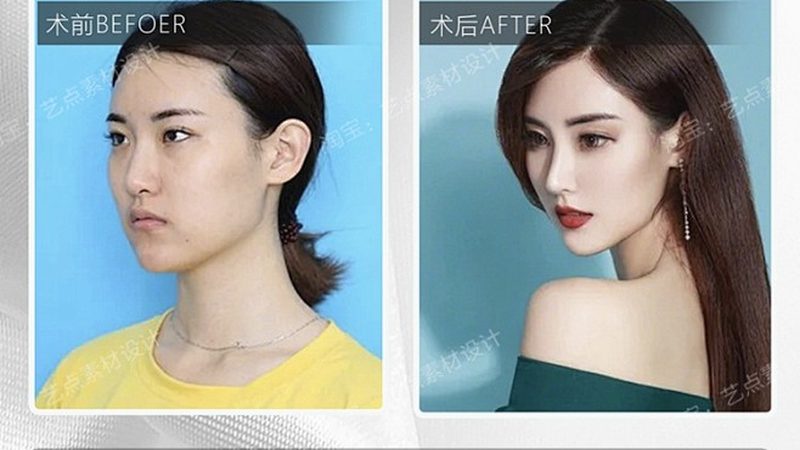光子嫩肤后反黑？揭秘修复方法与预防技巧**