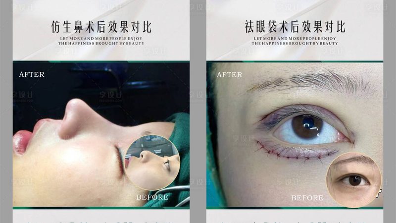 水光针注射，揭秘其注射步骤与注意事项