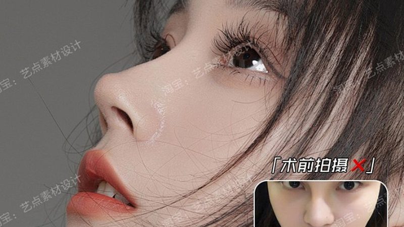 激光祛斑费用价目表