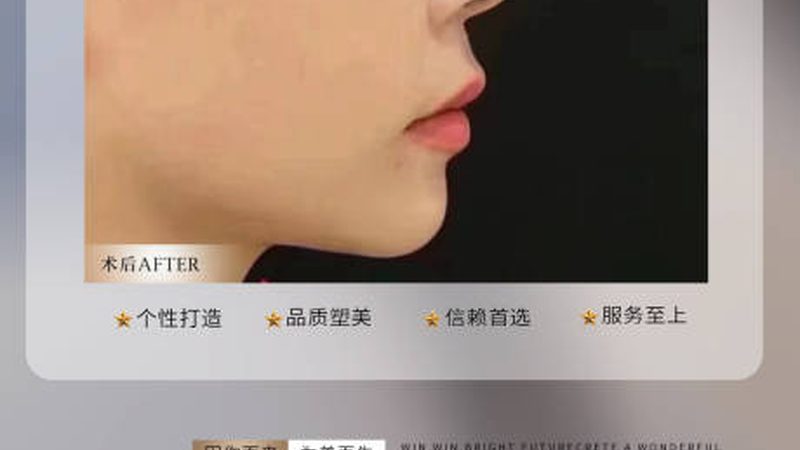 上海玻尿酸批发加盟，政策解读与市场洞察