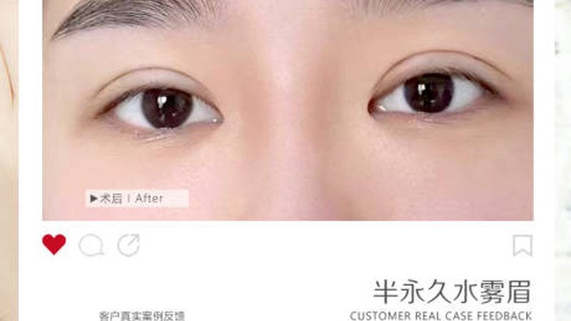 医美咨询师流程优化：提升服务质量的关键步骤