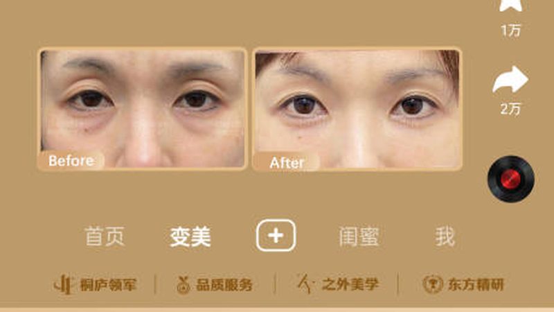 皮肤管理项目区别与美容院
