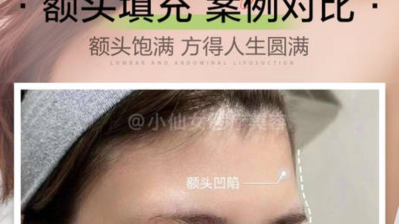 家用瘦脸仪器主要通过以下几种原理来实现瘦脸效果：